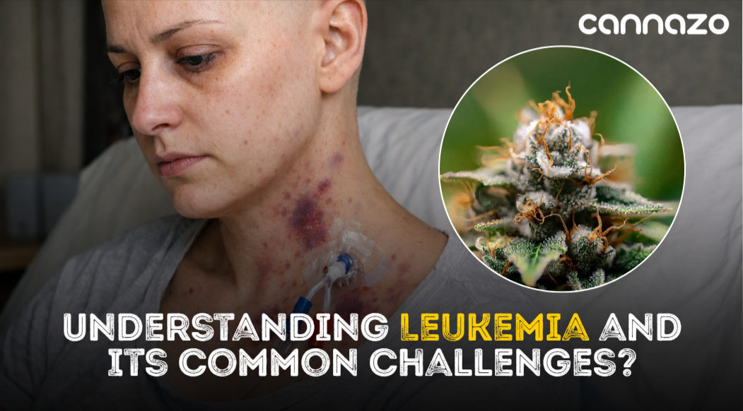 CBD Oil for Leukemia Symptoms and Side Effects: Can It Help?