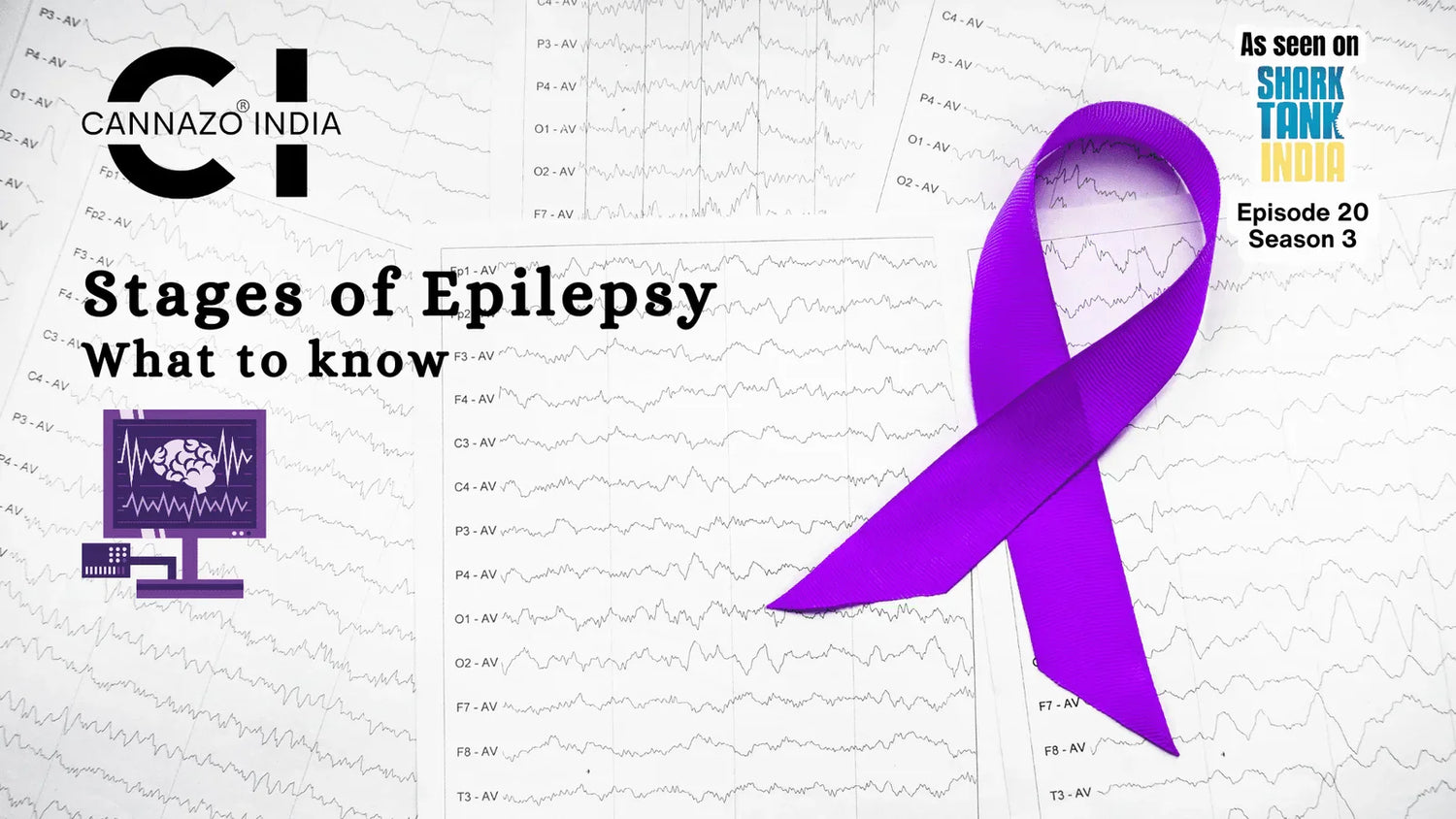 Stages of Epilepsy: What to Know