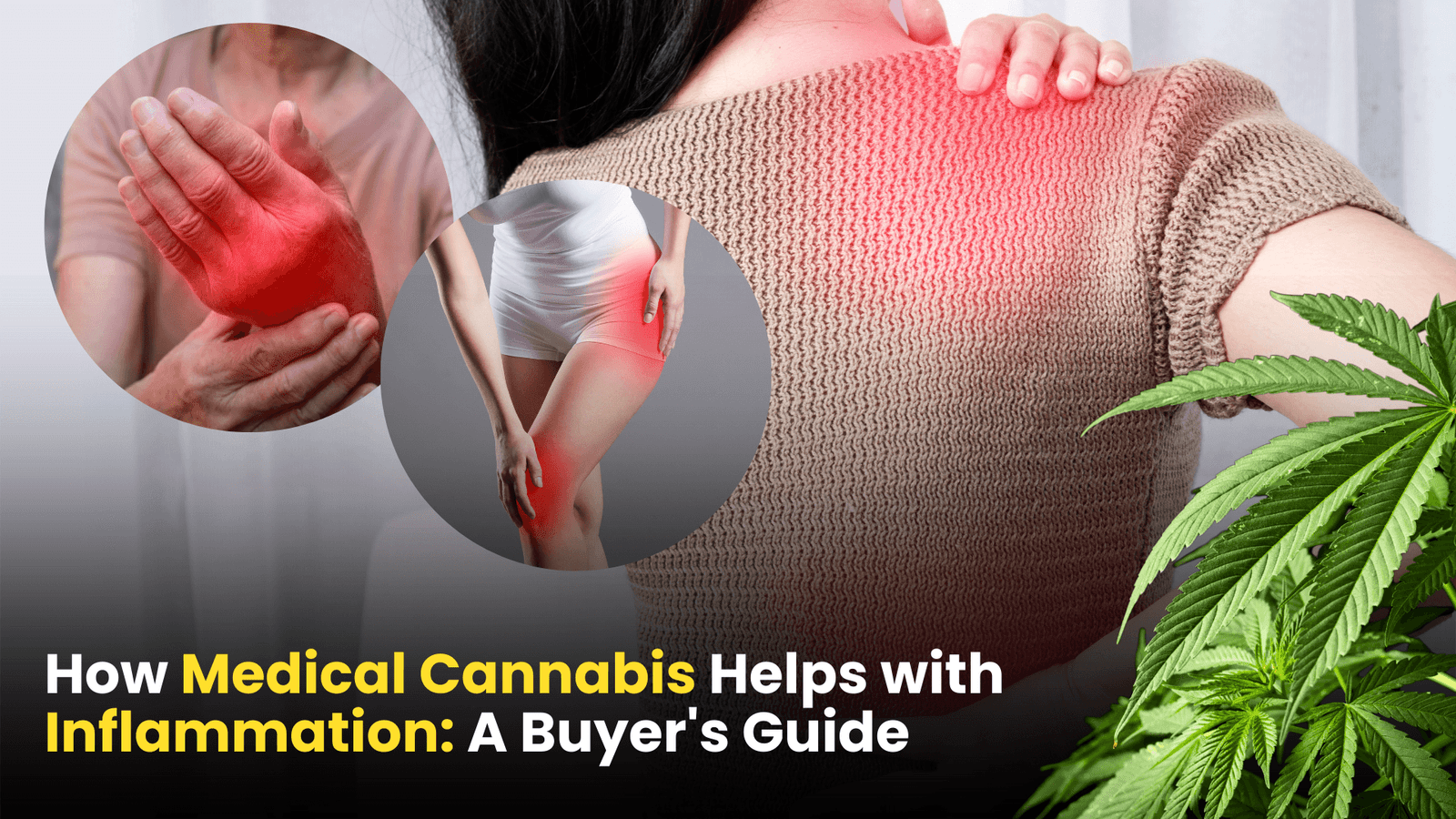 medical cannabis for inflammation