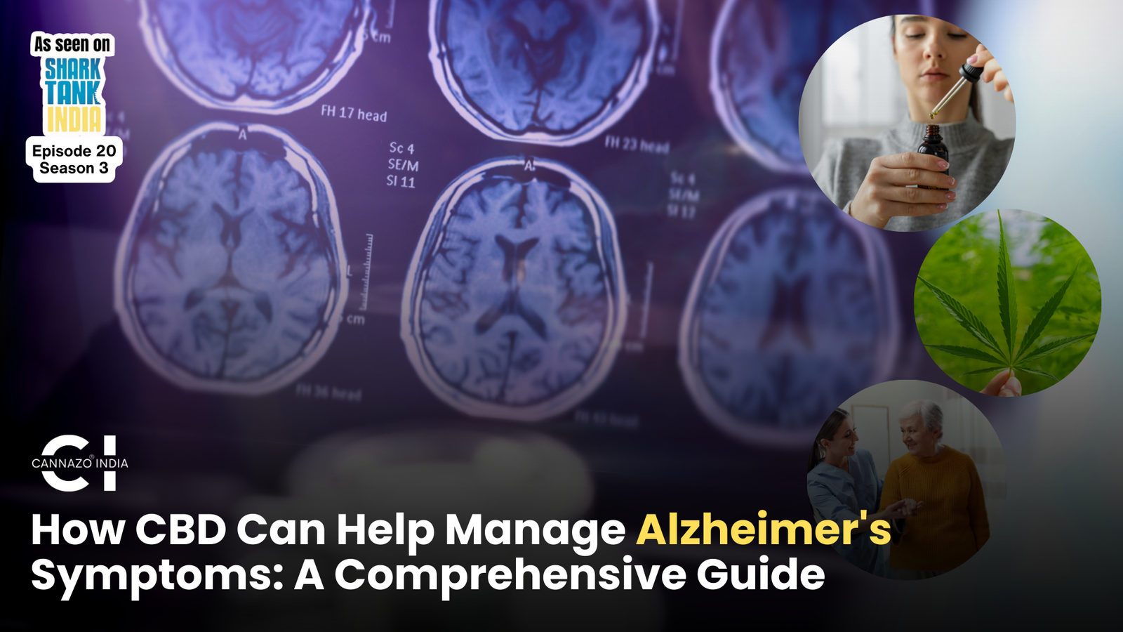 CBD for Alzheimer’s