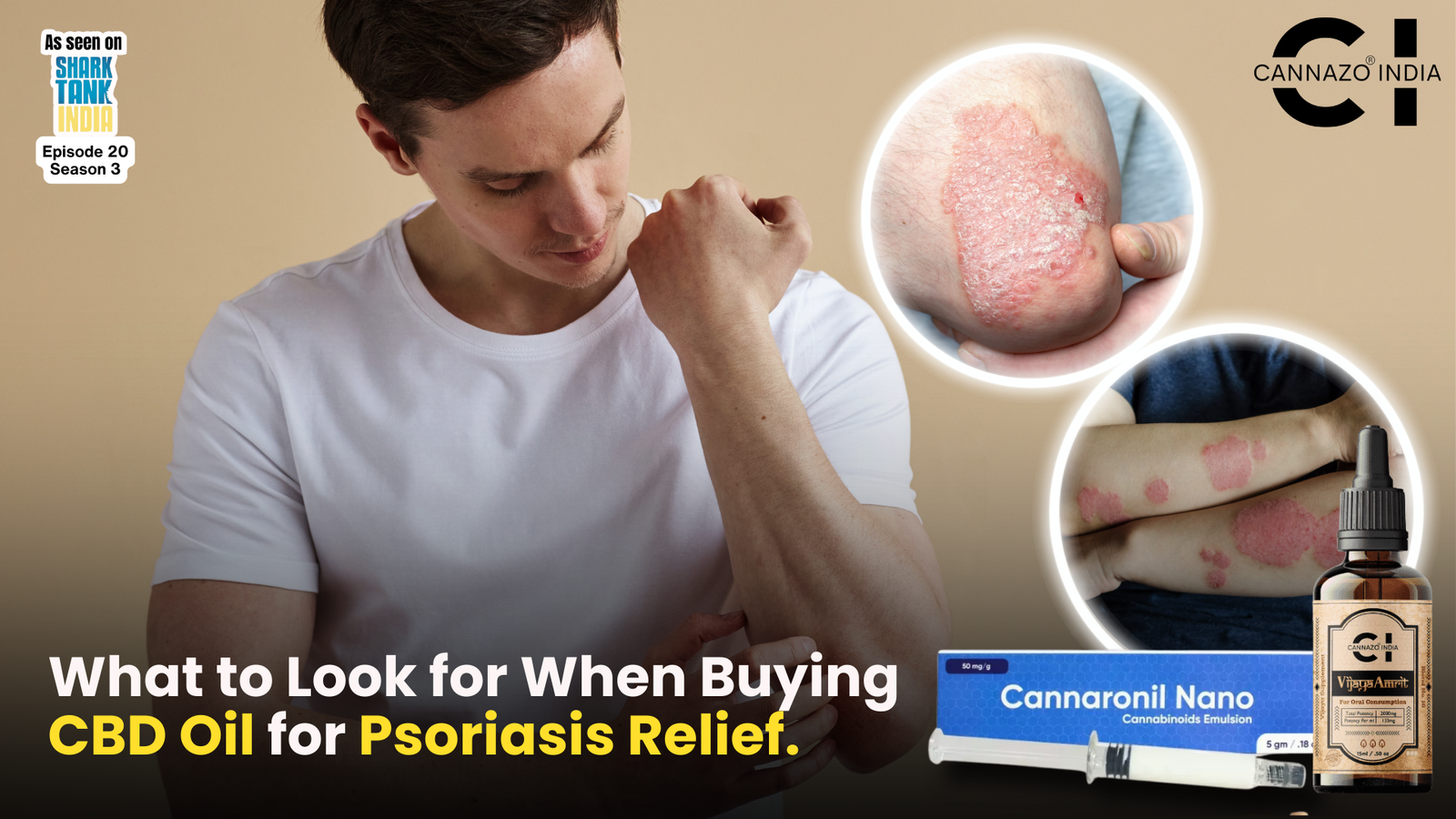 CBD Oil for Psoriasis