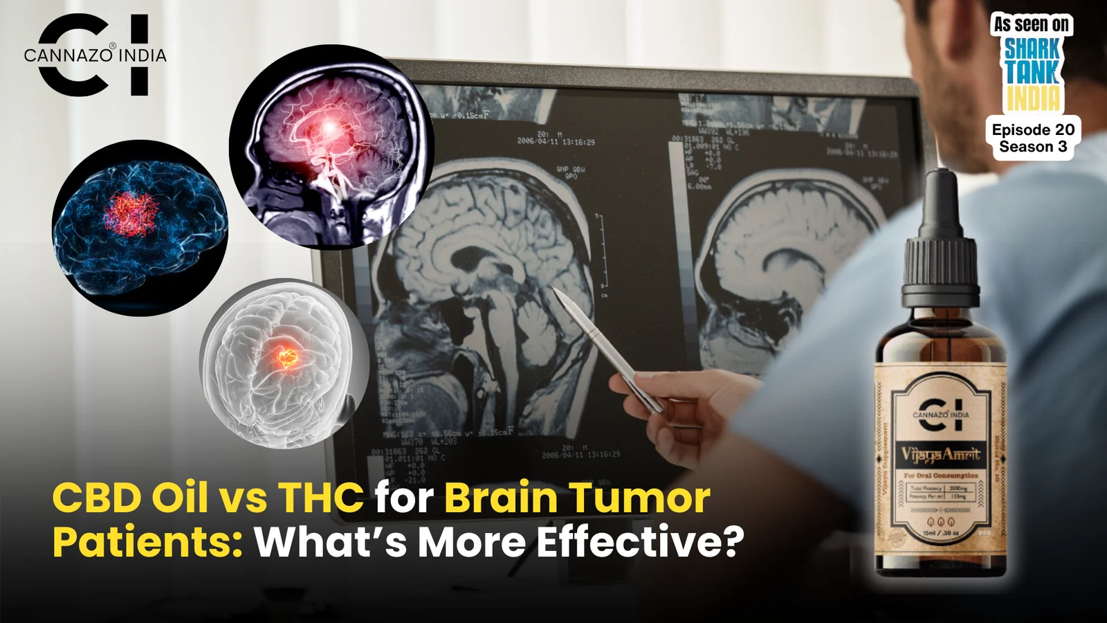 cbd oil vs thc for brain tumour patients
