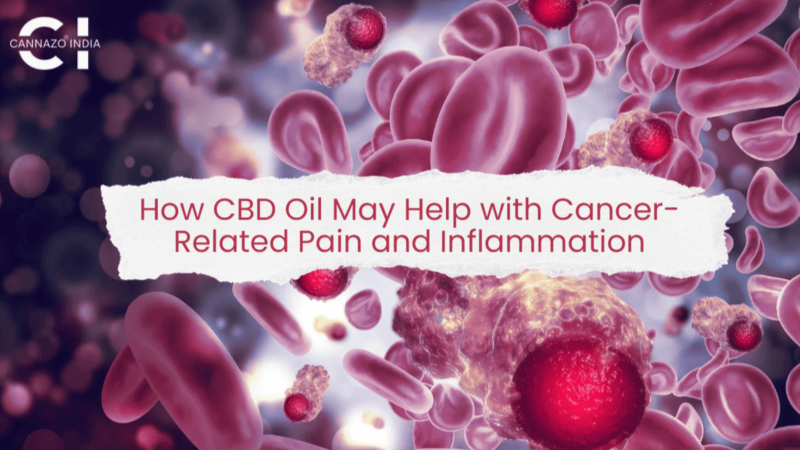 How CBD Oil May Help with Cancer-Related Pain and Inflammation
